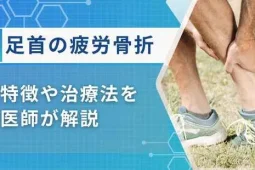 足首疲労骨折 アイキャッチ画像