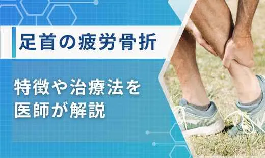 足首疲労骨折 アイキャッチ画像