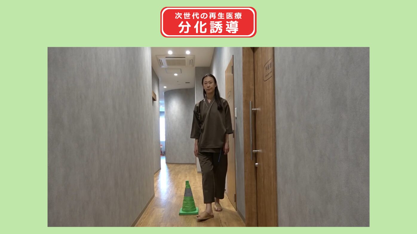 分化誘導 変形性股関節症