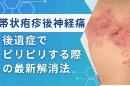 帯状疱疹後神経痛の最新解消法