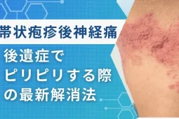 帯状疱疹後神経痛の最新解消法