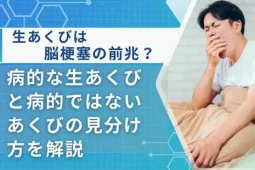 脳梗塞 生あくび