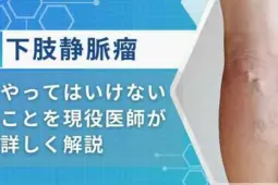 下肢静脈瘤やってはいけないこと