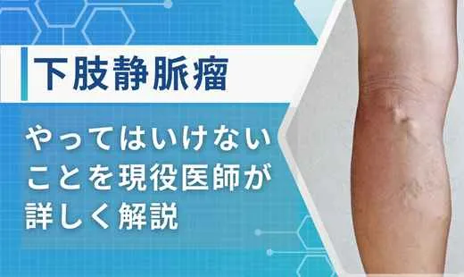 下肢静脈瘤やってはいけないこと