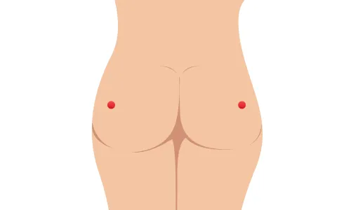 環跳（かんちょう）の画像