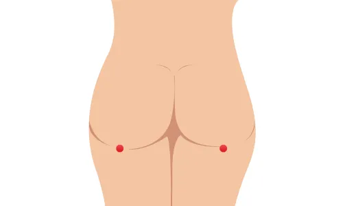 承扶（しょうふ）の画像