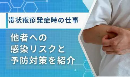 帯状疱疹 仕事