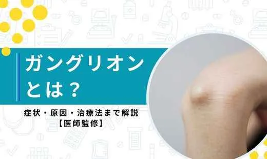 ガングリオン