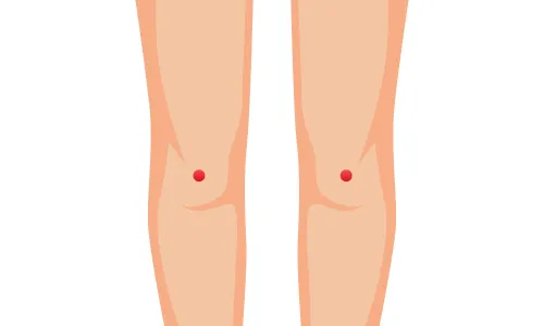 委中（いちゅう）の画像