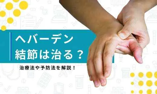 ヘバーデン結節 治る