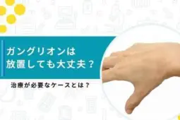 ガングリオン 放置
