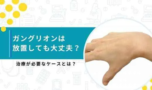 ガングリオン 放置