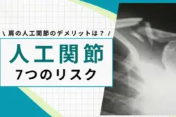 人工関節