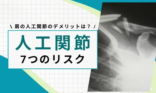 人工関節