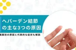 ヘバーデン結節 原因
