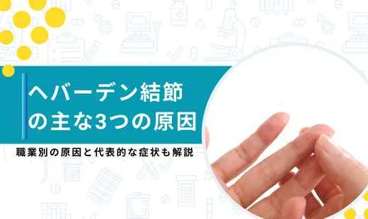 ヘバーデン結節 原因