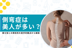 側弯症 美人が多い
