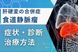 肝硬変 食道静脈瘤