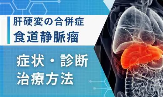 肝硬変 食道静脈瘤