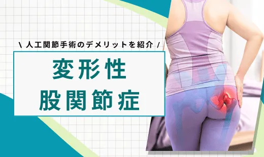 変形性股関節症 手術 デメリット
