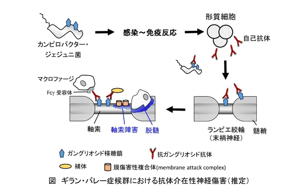 ギラン・バレー症候群のメカニズム