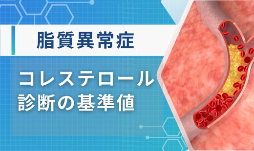 脂質異常症の診断基準