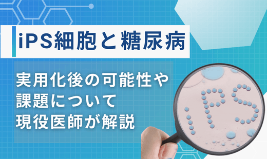 ips細胞と糖尿病