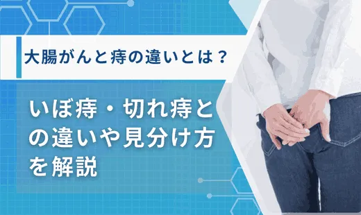 大腸がんと痔の違い