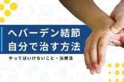 ヘバーデン結節 自分で治す方法