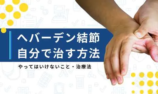 ヘバーデン結節 自分で治す方法