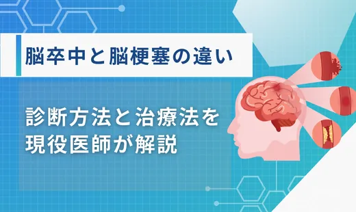脳卒中と脳梗塞の違い