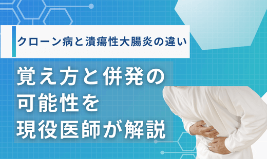 クローン病と潰瘍性大腸炎の違い