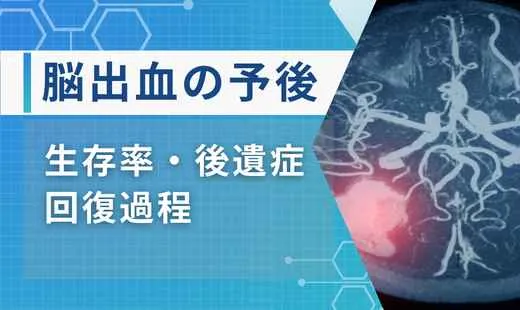 脳出血 予後