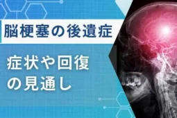 脳梗塞 後遺症 とは