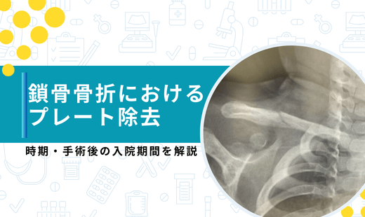 骨折プレート除去 入院期間