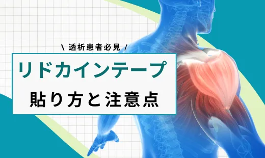 リドカインテープ貼り方