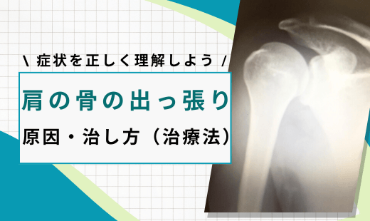 肩の骨 出っ張り