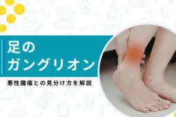 ガングリオン 足