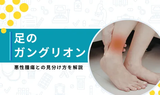 ガングリオン 足