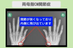 大阪院-1144 症例画像