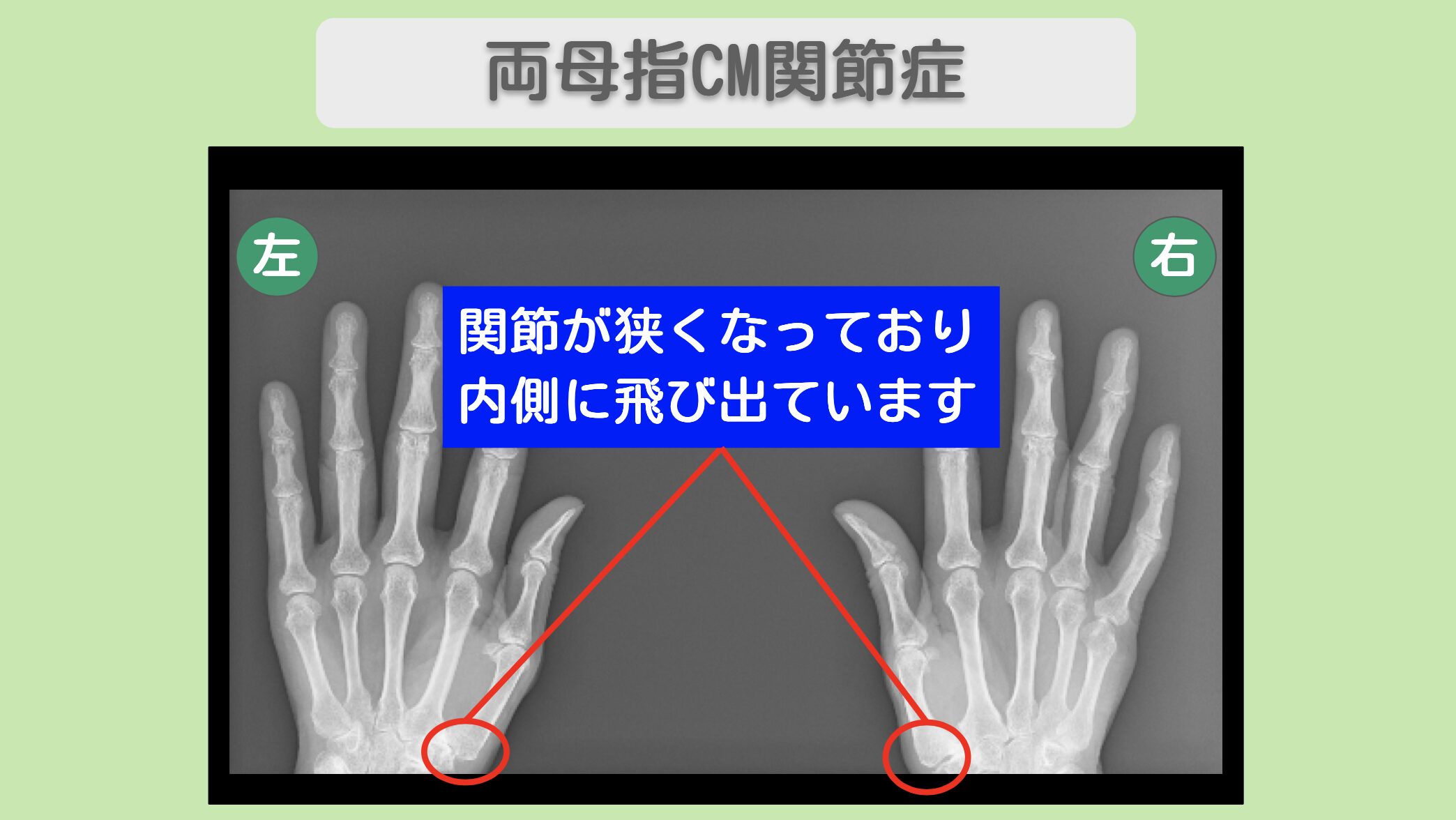 大阪院-1144 症例画像