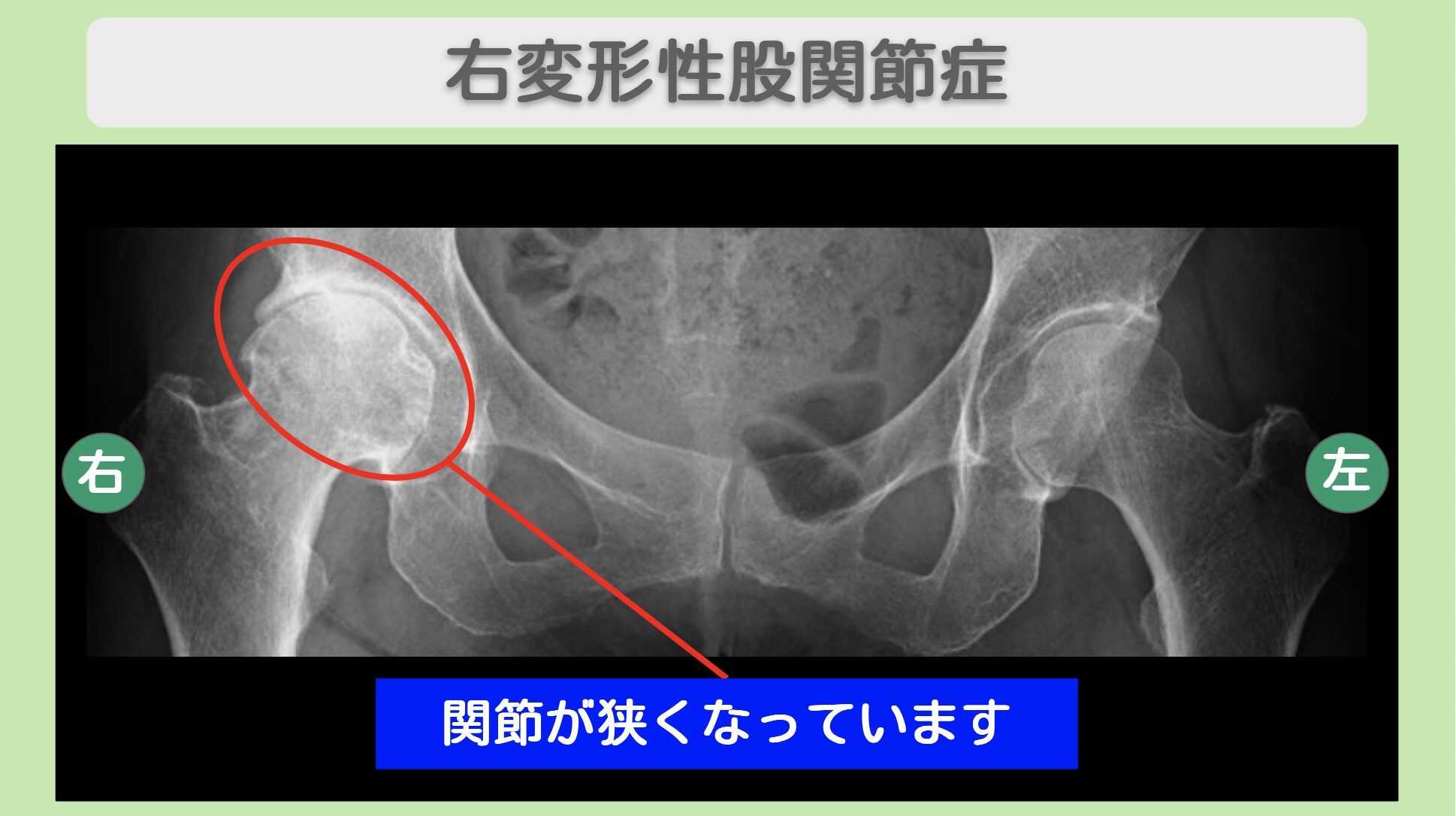東京院-1013 症例画像