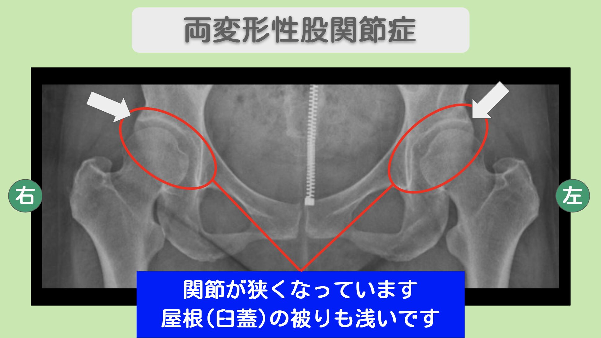 東京院-1041 症例画像