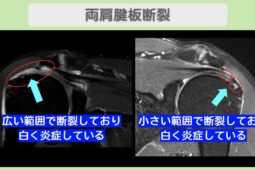 東京院-540 症例画像