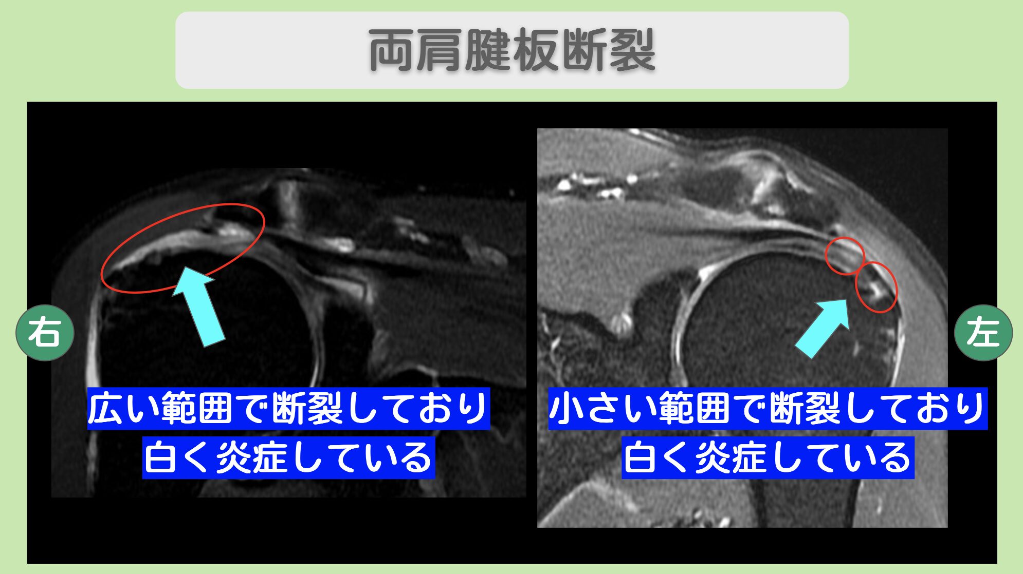 東京院-540 症例画像