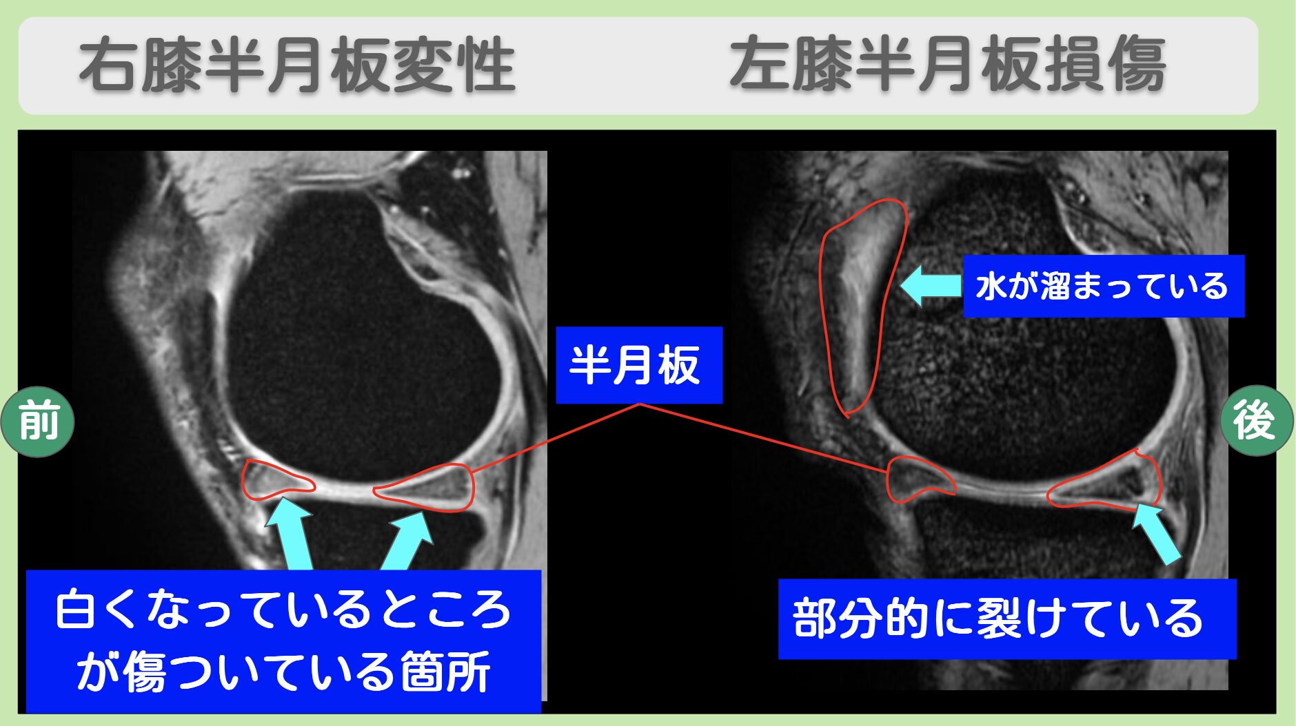 東京院-540 症例画像