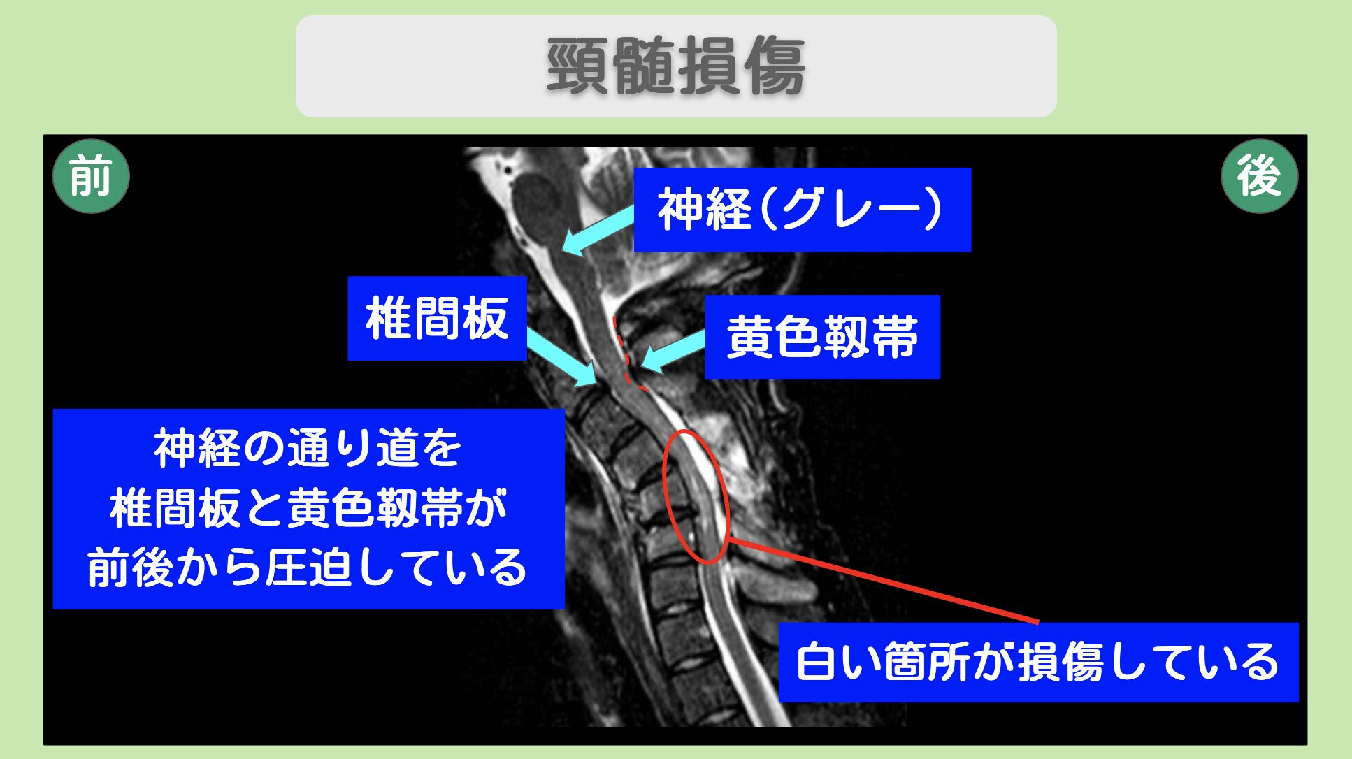 東京院-541 症例画像