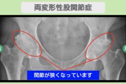 東京院-899 症例画像