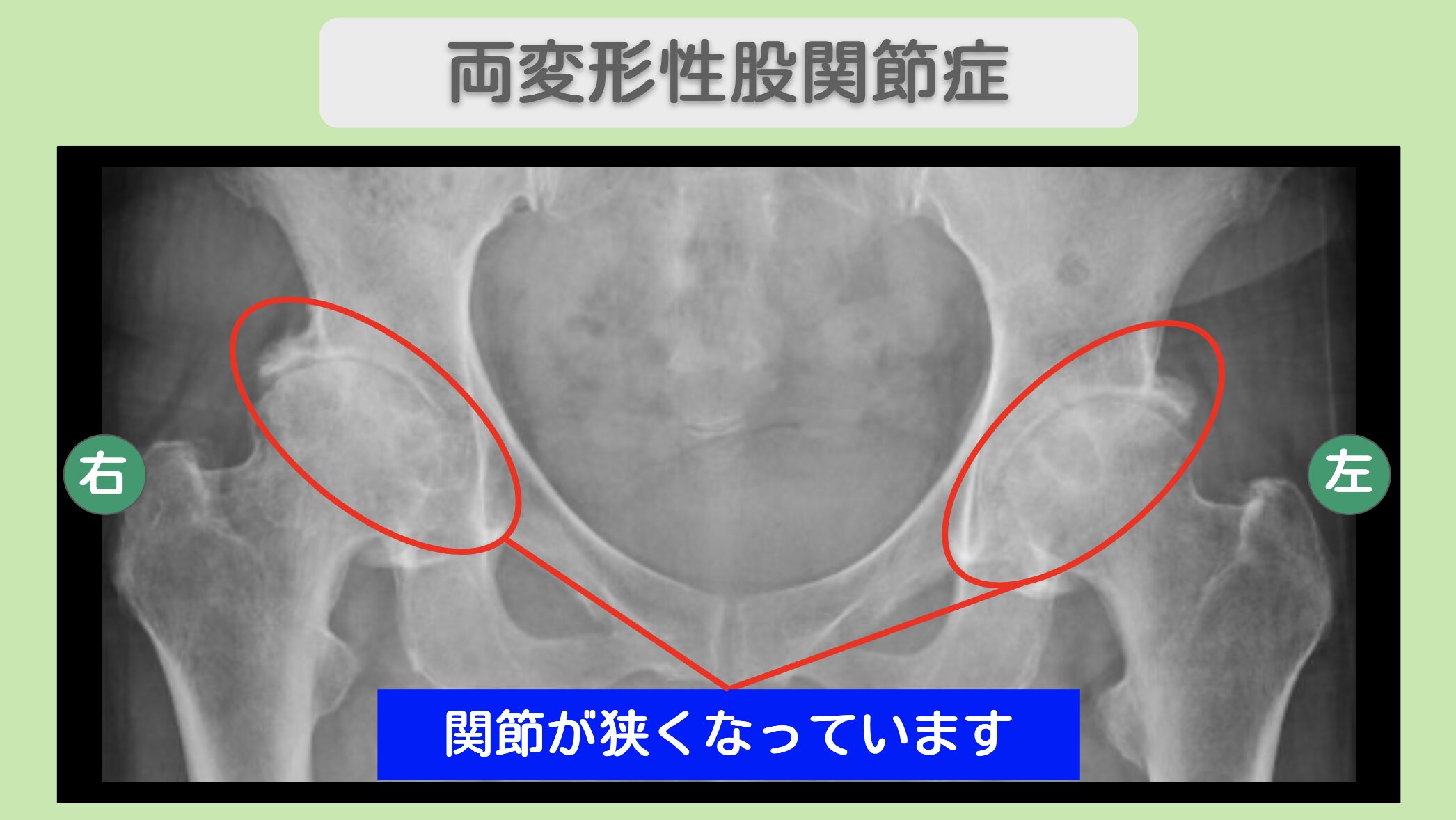 東京院-899 症例画像