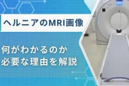 ヘルニア mri